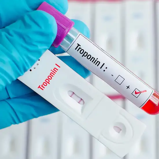 troponin i test